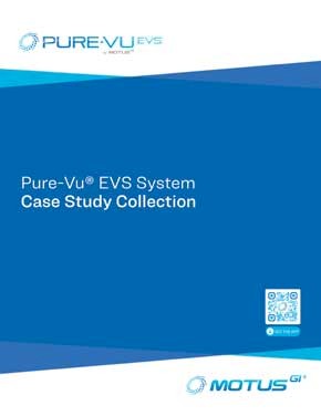 Pure-Vu Case Study Collection Download